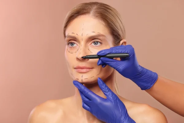 Open vs. Closed Rhinoplasty