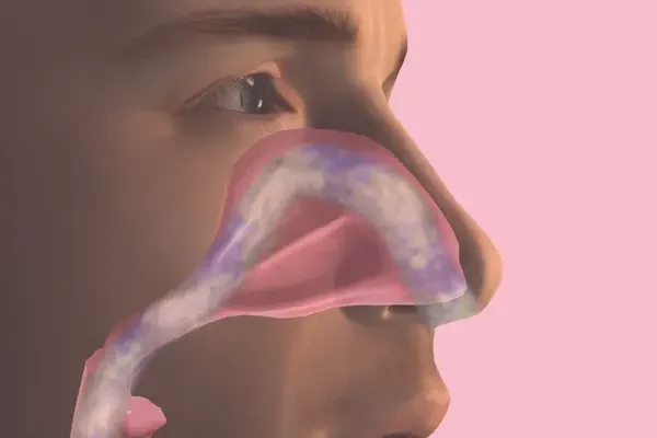 Burun Eti Küçültme